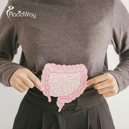 عملية تحويل مسار المعدة المصغرة في تركيا للمرضى الذين يركزون على إدارة الوزن على المدى الطويل